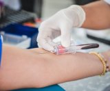 Kolesterol je jedan od ključnih čimbenika rizika za srčani i moždani udar