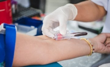 Kolesterol je jedan od ključnih čimbenika rizika za srčani i moždani udar