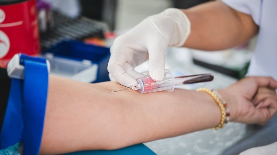 Kolesterol je jedan od ključnih čimbenika rizika za srčani i moždani udar