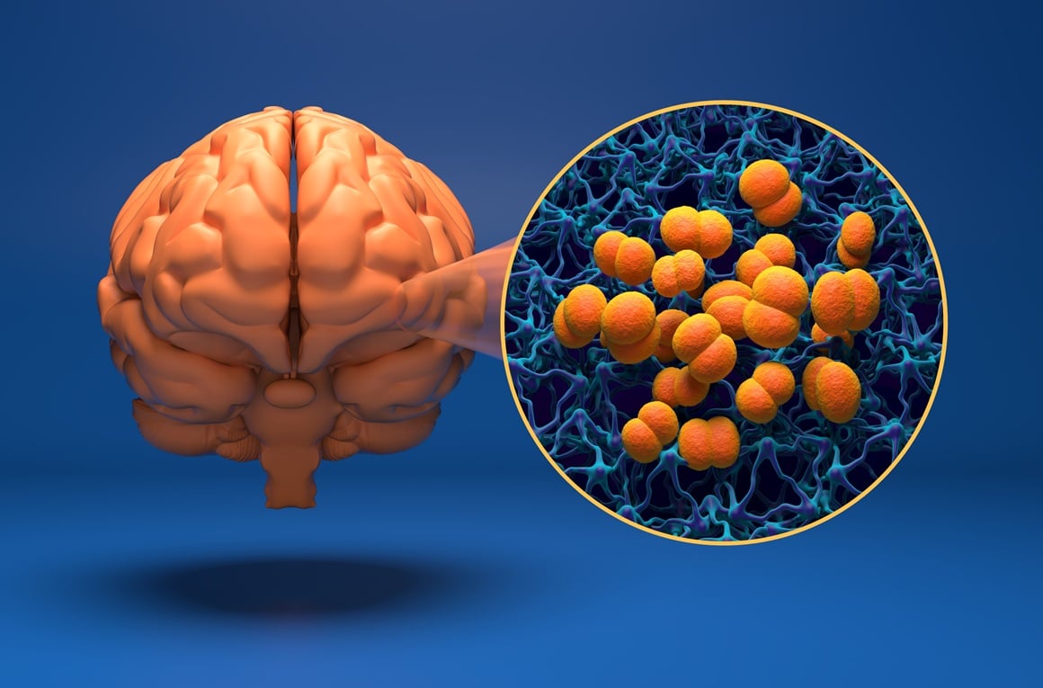 Meningitis B je ozbiljna bakterijska infekcija koju uzrokuje bakterija Neisseria meningitidis skupine B