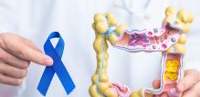 Novo izvješće Američkog društva za borbu protiv raka (American Cancer Society - ACS) upozorava na porast slučajeva kolorektalnog raka među mlađim odraslim osobama