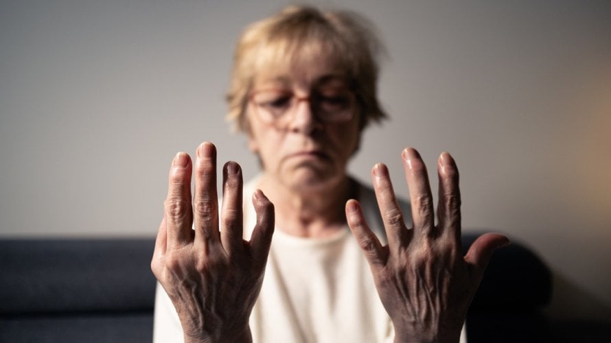 Reumatoidni artritis i životni vijek