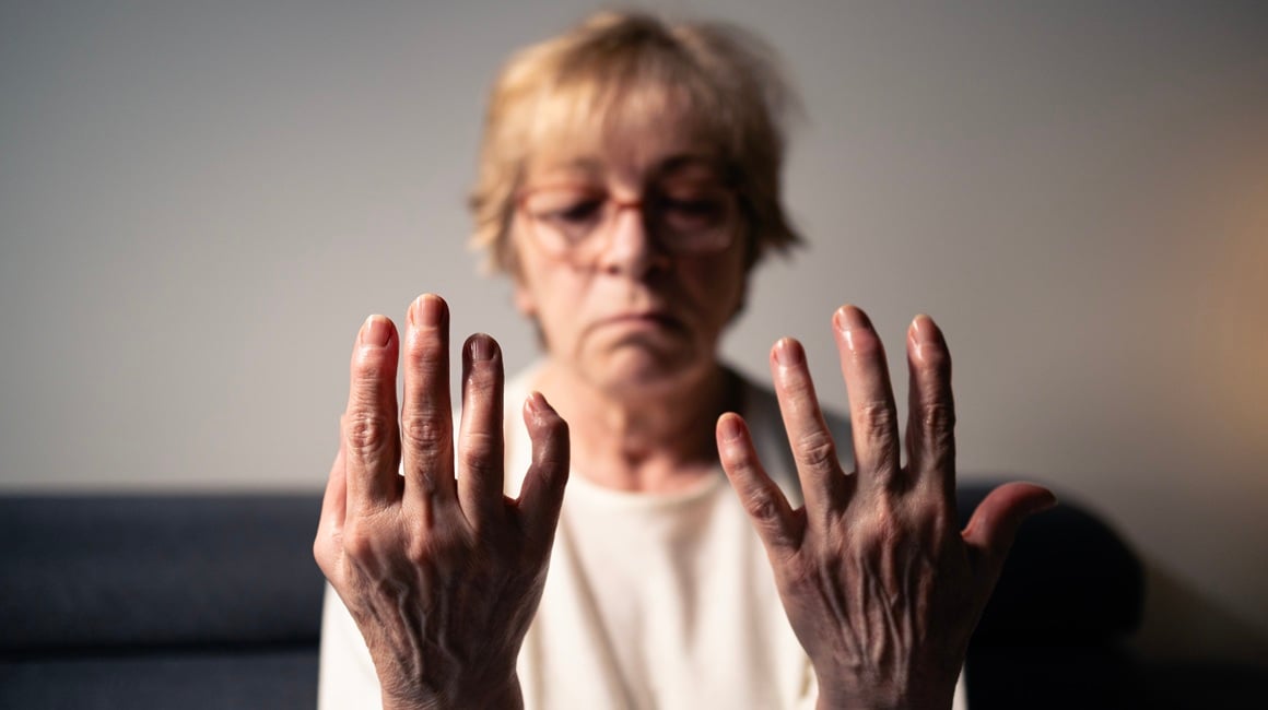 Reumatoidni artritis i životni vijek