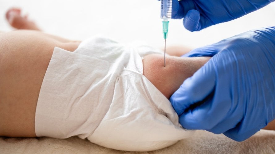 Sve više roditelja odbija injekciju vitamina K za novorođenčad, iako liječnici upozoravaju da ona može spriječiti ozbiljna krvarenja i oštećenja mozga