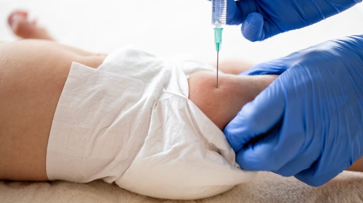 Sve više roditelja odbija injekciju vitamina K za novorođenčad, iako liječnici upozoravaju da ona može spriječiti ozbiljna krvarenja i oštećenja mozga