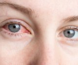 bakterija Chlamydia pneumoniae, poznata kao uzročnik upala sinusa i pluća, može se zadržati u oku godinama - i pritom potencijalno povećati rizik od Alzheimerove bolesti