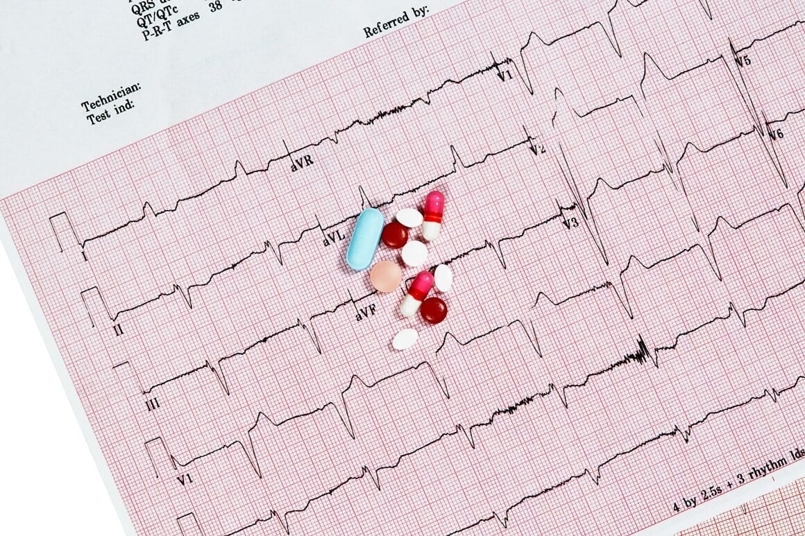 kombinacija diltiazema s apiksabanom ili rivaroksabanom može povećati rizik od ozbiljnih krvarenja