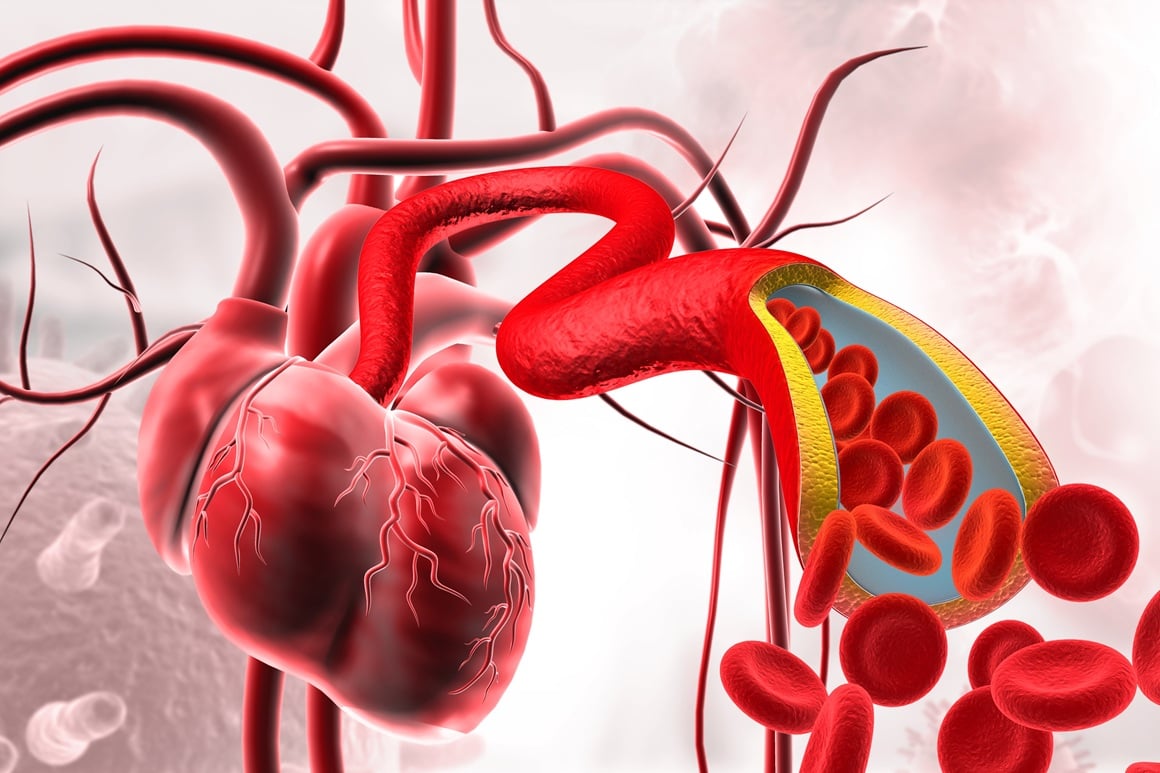 najčešće kardiovaskularne bolesti