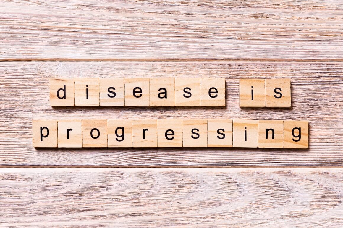 progresija - značenje