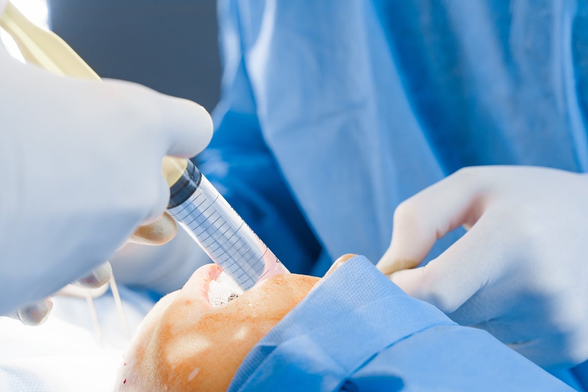 uklanjanje masti iz obraza