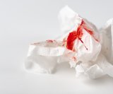 važno je obratiti pozornost na neobične oblike krvarenja koje vaše tijelo može signalizirati