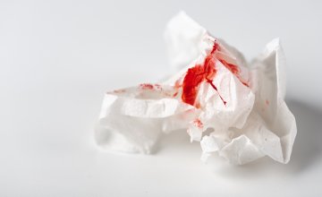 važno je obratiti pozornost na neobične oblike krvarenja koje vaše tijelo može signalizirati