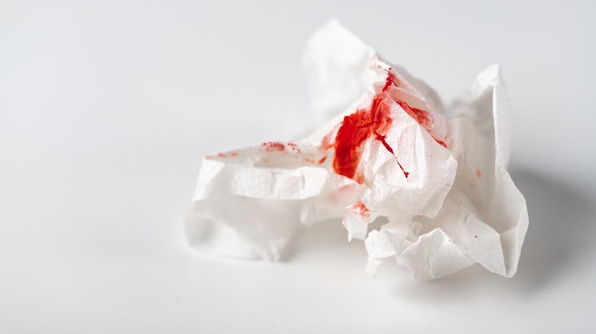 važno je obratiti pozornost na neobične oblike krvarenja koje vaše tijelo može signalizirati