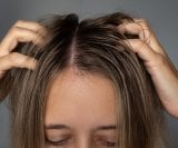 vlasište je živo tkivo koje sadrži folikule dlake, lojne žlijezde, živce i imunološke stanice