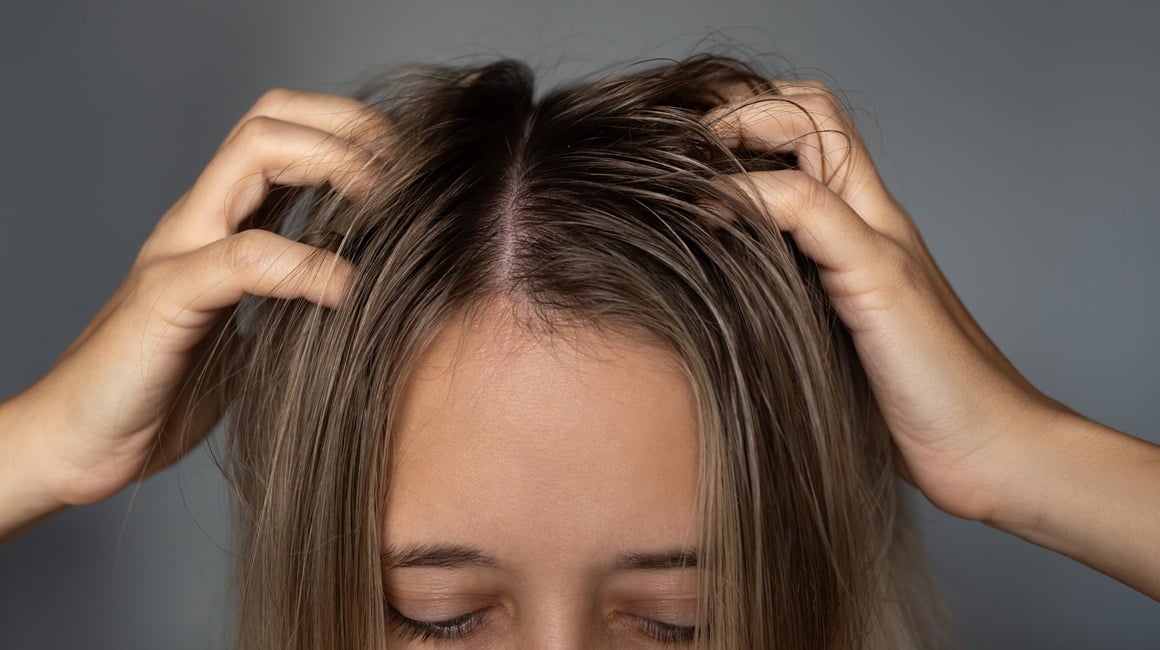 vlasište je živo tkivo koje sadrži folikule dlake, lojne žlijezde, živce i imunološke stanice