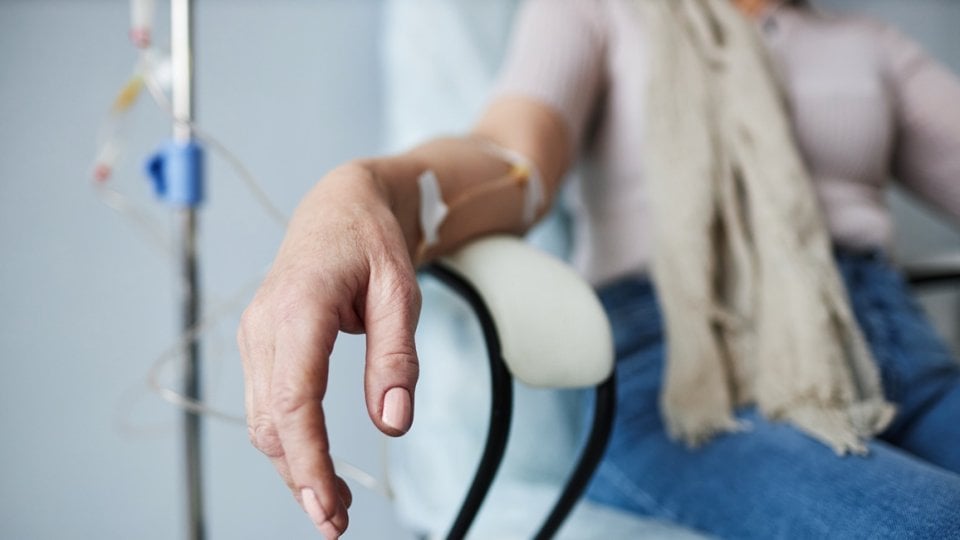 žene imaju veću vjerojatnost preživjeti rak u usporedbi s muškarcima, no češće razvijaju ozbiljne nuspojave terapije