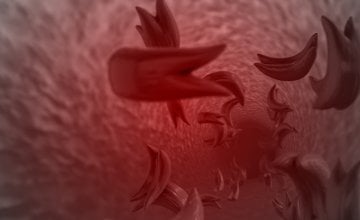 Bol je jedan od najčešćih i najtežih simptoma bolesti srpastih stanica