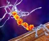 Bolest motornog neurona