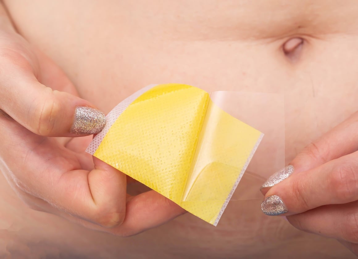 Flasteri za mršavljenje - iskustva