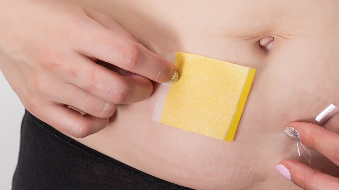 Flasteri za mršavljenje