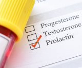 Hiperprolaktinemija