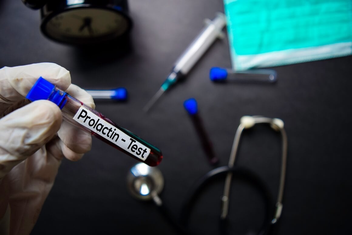 Hiperprolaktinemija - liječenje
