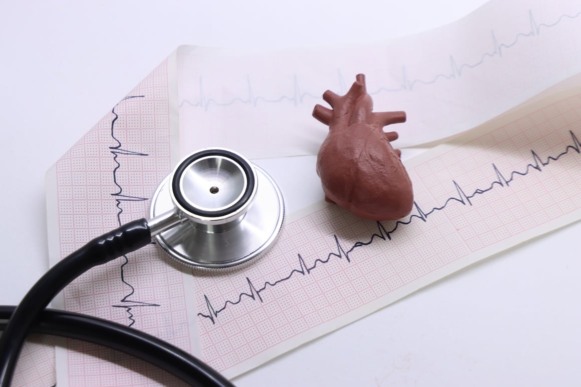 Ishemijska bolest srca - liječenje