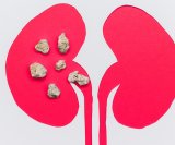 Magnezij i bubrežni kamenci