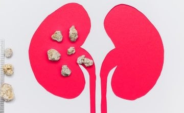 Magnezij i bubrežni kamenci