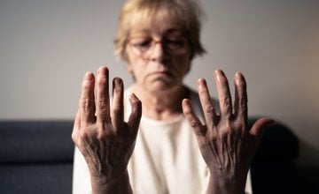 Novo istraživanje pokazuje da osobe koje boluju od autoimunih bolesti imaju povećan rizik od razvoja raka, osobito u prvoj godini nakon postavljanja dijagnoze