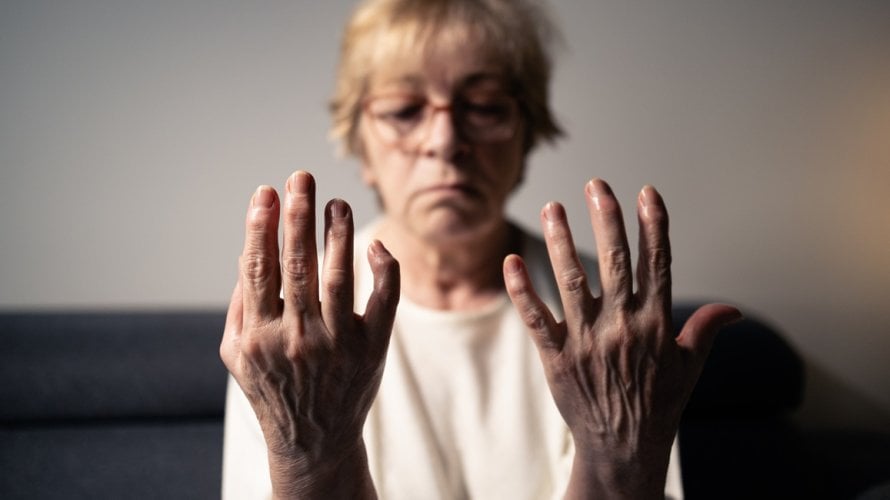 Novo istraživanje pokazuje da osobe koje boluju od autoimunih bolesti imaju povećan rizik od razvoja raka, osobito u prvoj godini nakon postavljanja dijagnoze