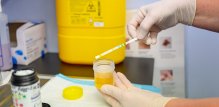 Novorazvijeni brzi test urina mogao bi omogućiti preciznije i učinkovitije liječenje infekcija mokraćnog sustava