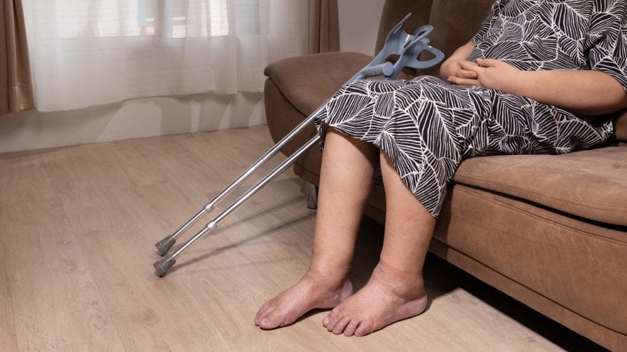 Otkazivanje bubrega kod starijih osoba