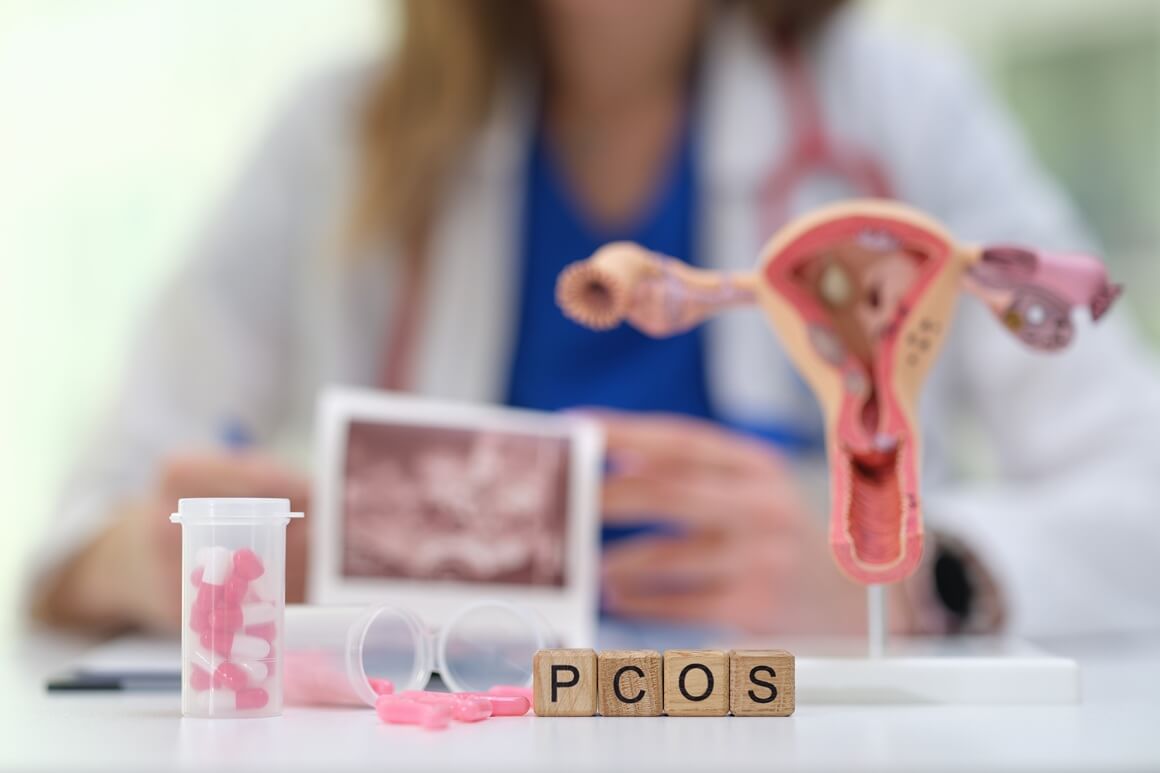 PCOS je hormonski poremećaj kod kojeg tijelo ne proizvodi dovoljno ženskih hormona potrebnih za ovulaciju