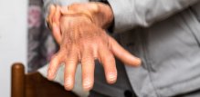 Parkinsonova bolest - komplikacije