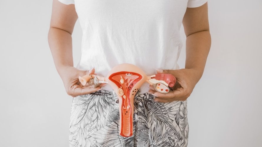 Povremeni post može pomoći kod simptoma PCOS-a