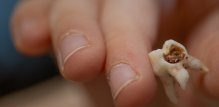 fluoridacija vode jedna od najučinkovitijih i najdostupnijih preventivnih mjera za očuvanje oralnog zdravlja djece