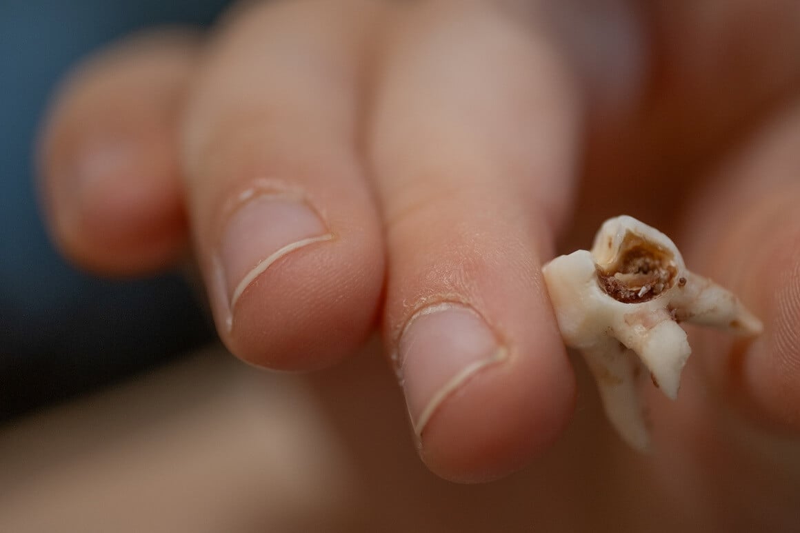 fluoridacija vode jedna od najučinkovitijih i najdostupnijih preventivnih mjera za očuvanje oralnog zdravlja djece