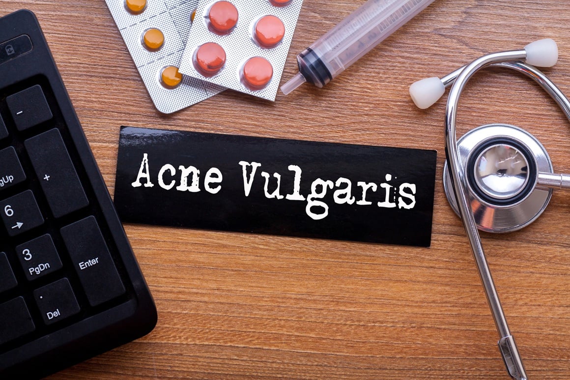 liječenje akni uzrokovanih kortikosteroidima