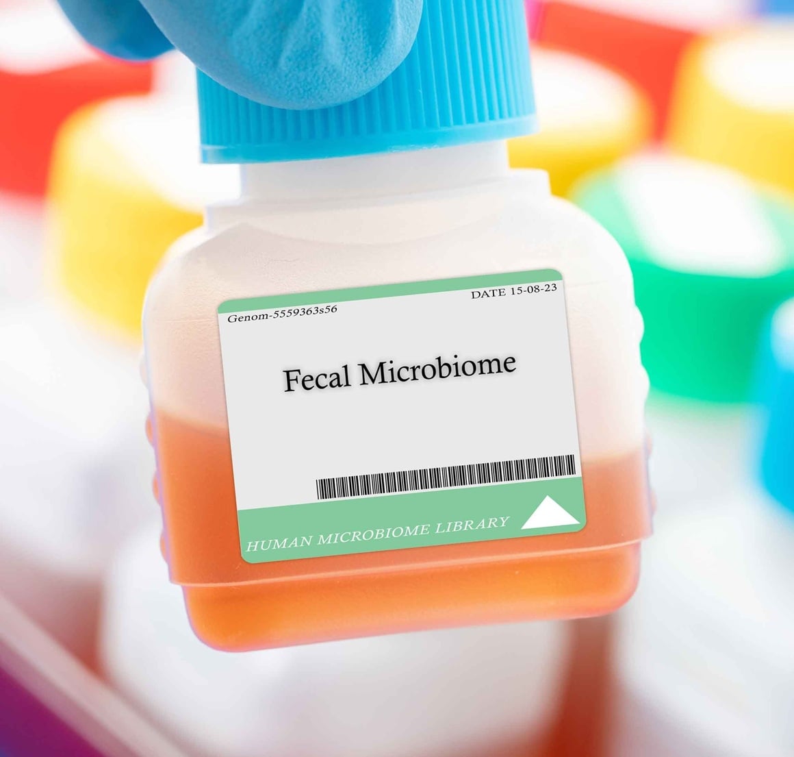 pravovremeno liječenje transplantacijom fekalne mikrobiote može poboljšati izglede za preživljavanje osoba s po život opasnom infekcijom bakterijom C. difficile