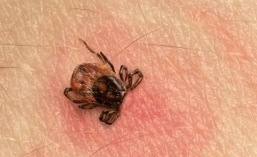 Ako nakon boravka u prirodi osjećate ovo, nemojte ignorirati moguće znakove Lymeove bolesti