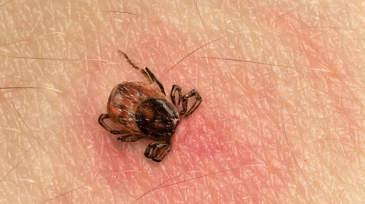 Ako nakon boravka u prirodi osjećate ovo, nemojte ignorirati moguće znakove Lymeove bolesti