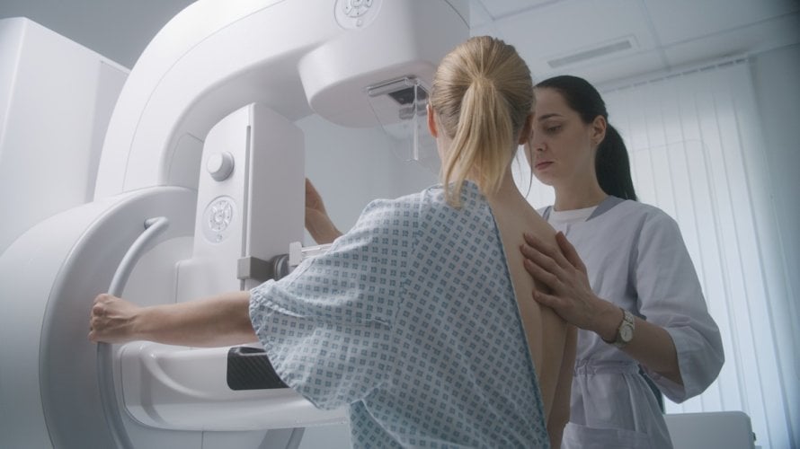 Američki liječnički kolegij (ACP) objavio je nove smjernice za mamografske preglede