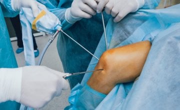 Istraživanje objavljeno u časopisu The New England Journal of Medicine dovodi u pitanje učinkovitost djelomičnog uklanjanja meniskusa