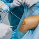 Istraživanje objavljeno u časopisu The New England Journal of Medicine dovodi u pitanje učinkovitost djelomičnog uklanjanja meniskusa
