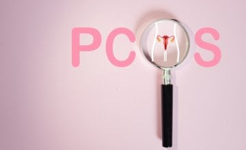 Sindrom policističnih jajnika (PCOS) dobio je novo ime - poliendokrini metabolički ovarijski sindrom (PMOS)