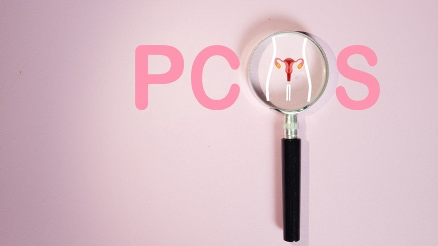 Sindrom policističnih jajnika (PCOS) dobio je novo ime - poliendokrini metabolički ovarijski sindrom (PMOS)
