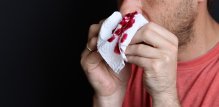 akutna mijeloična leukemija - simptomi
