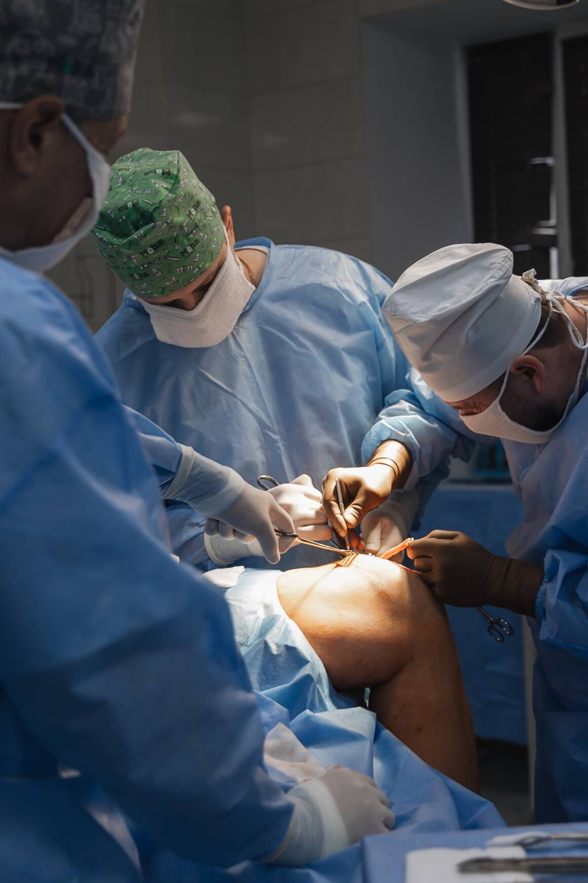  kako dodavanje dodatnog antibiotskog praška tijekom operacije složenih prijeloma kostiju ne smanjuje dodatno rizik od postoperativnih infekcija