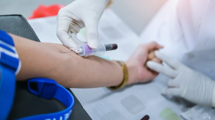 lipoprotein(a), poznat i kao Lp(a), može značajno povećati rizik od moždanog udara čak i kod osoba koje već primaju standardnu terapiju za kolesterol